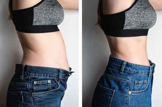 Antes e depois — Patrícia L. perdeu -9kg em 2 meses